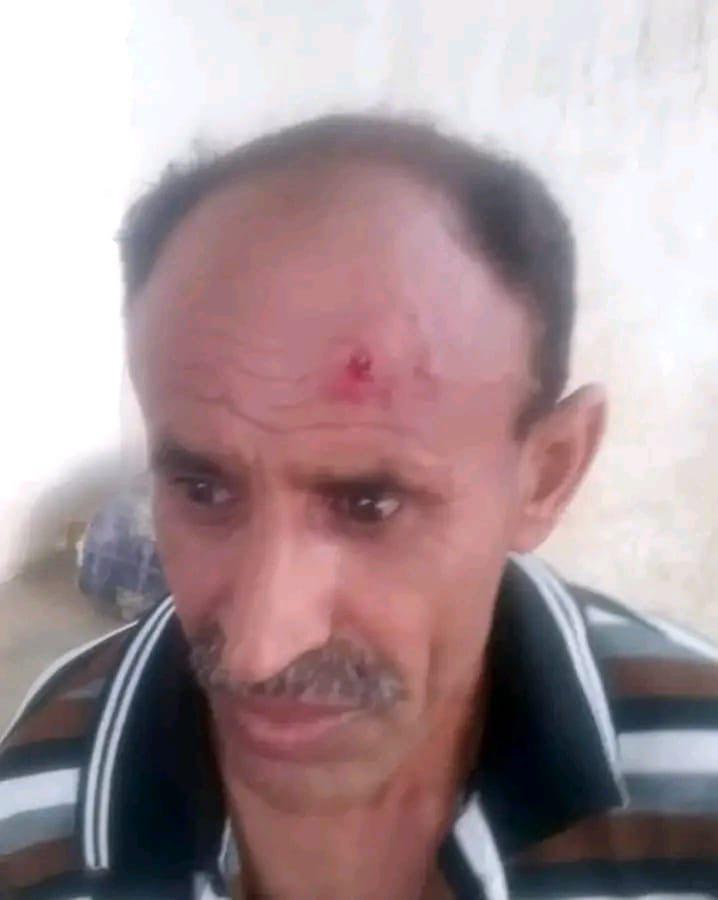 الحديدة.. مدير أمن الجراحي التابع لمليشيا الحوثي يعتدي بالضرب على أحد أفراد الأمن