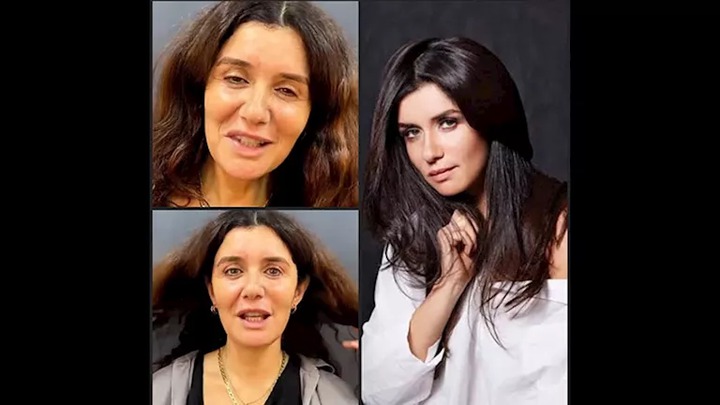 ظهور مفزع للفنانة غادة عادل بعد إجراء عملية تجميلية