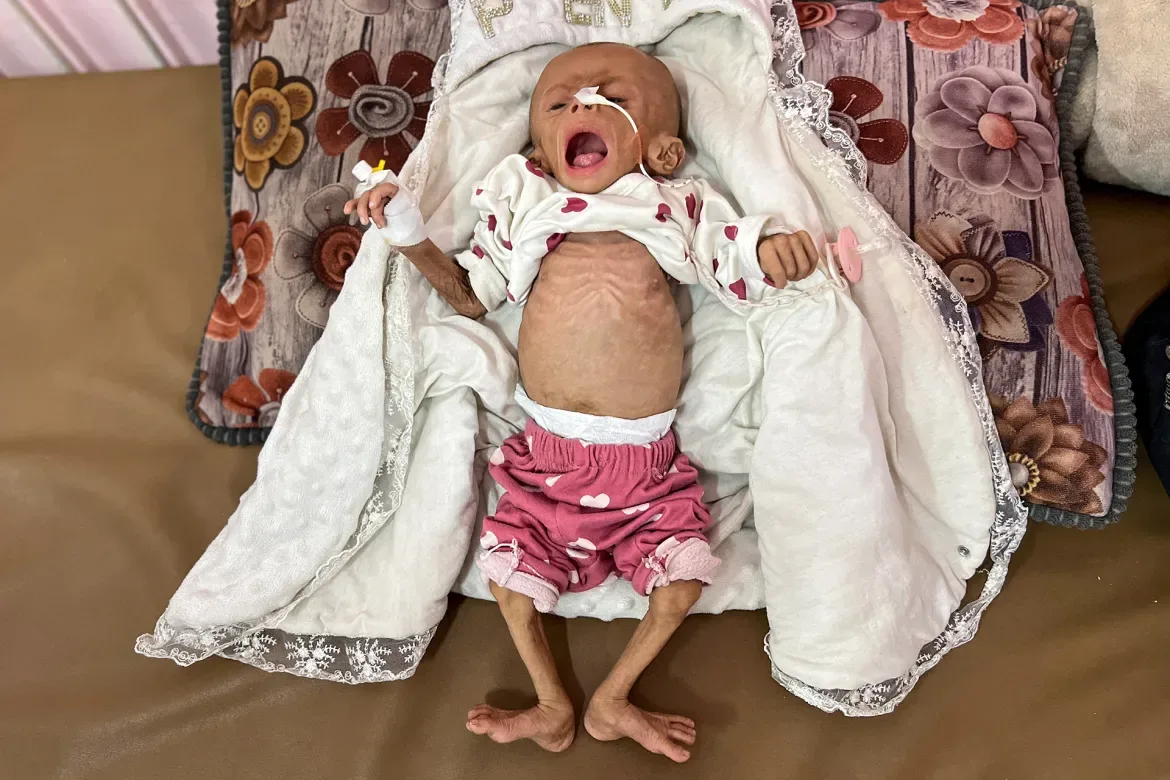 أطفال غزة بين الموت جوعا وأكل الرمال